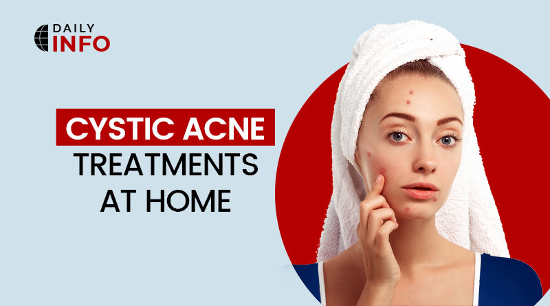 Acne Treatment